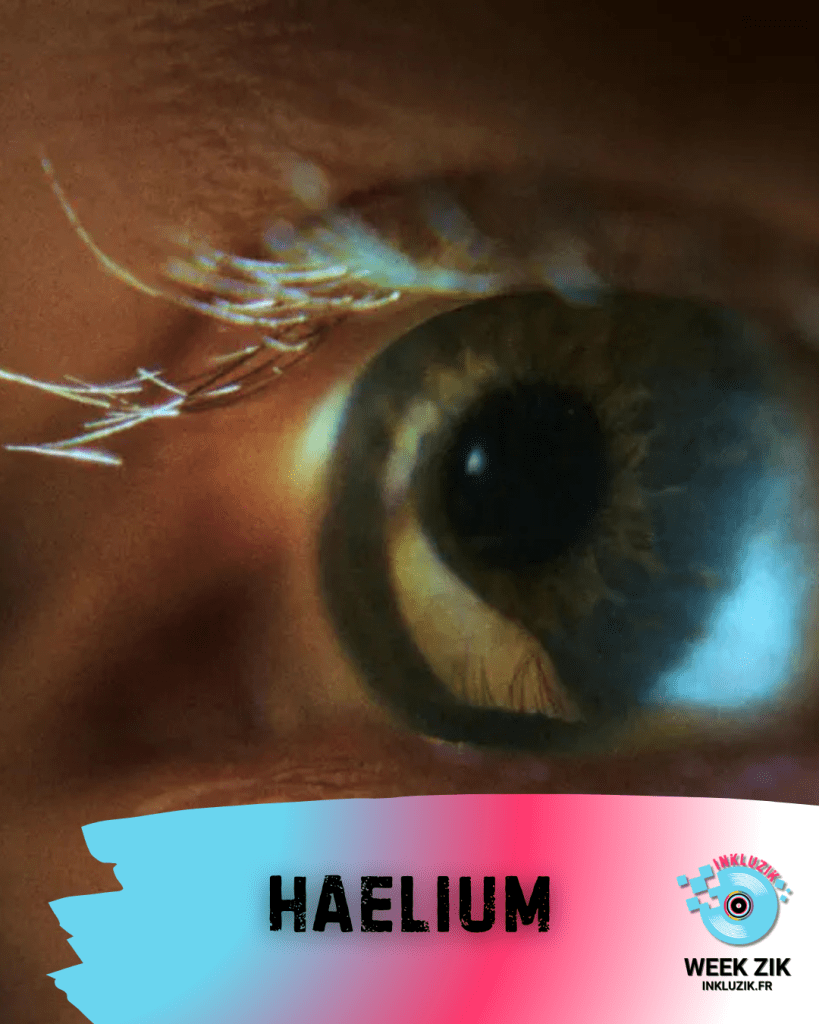 haelium-nystagmus